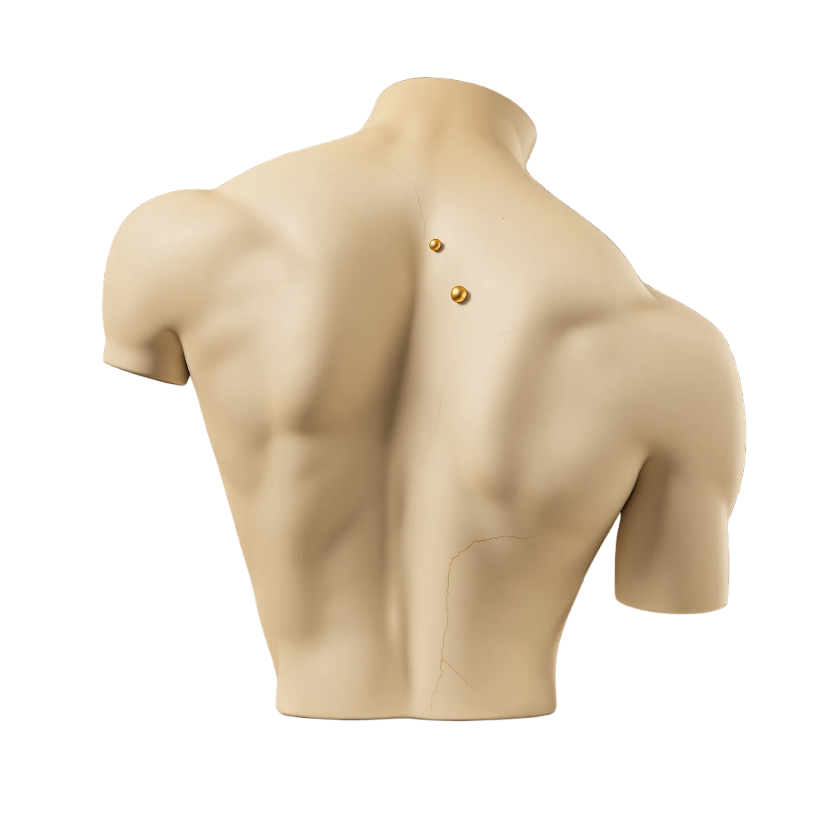 Trigger point-behandling